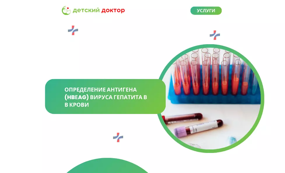 Определение антигена (HBеAg) вируса гепатита В в крови